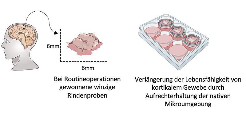 Universitätsklinikum Freiburg: Hirntumorforschung mit Humangewebe statt Tierversuchen.
Winzige Proben der Hirnrinde, die bei Routineoperationen ohnehin anfallen, werden im Labor kultiviert. So eignen sie für komplexe Experimente besonders gut. 

Foto: Universitätsklinikum Freiburg