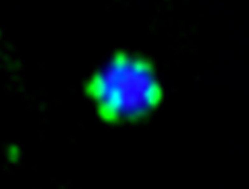 Forschende verstehen die Müllabfuhr unserer Zellen besser.
Unter dem Fluoreszenzmikroskop: Das Molekül Atg11 (grün) bildet kleine Tröpfchen auf der Oberfläche eines Protein-Aggregats (blau).

Foto: Albert-Ludwigs-Universität Freiburg - Mariya Licheva 